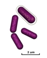 gram-negative rods